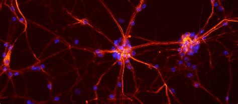 nöronlar yenilenir mi